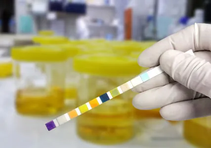 Infecțiile de tract urinar la bărbați – rare, dar destul de periculoase